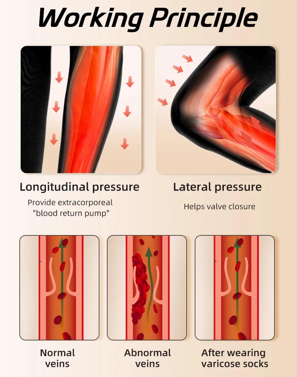 Adenbora Open Toe Compression Stocking: Soulagement élégant et efficace de la douleur liée à la maladie - Adenbora